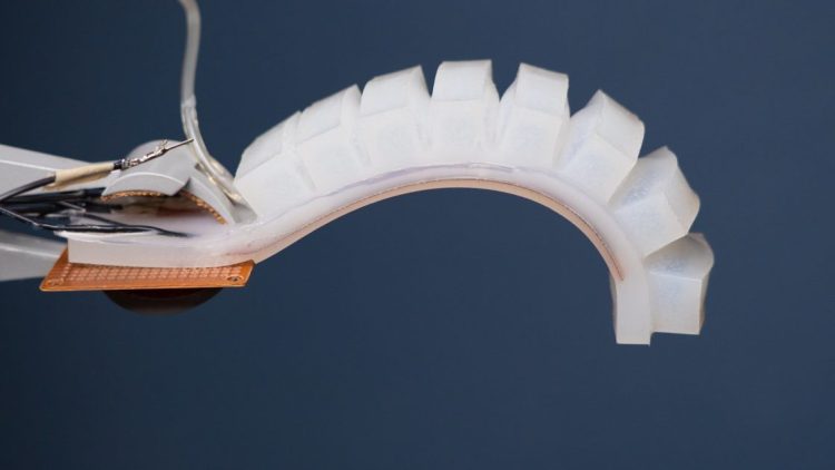 The Development of Soft and Biomimetic Robotics Makes Robot Applications in Dynamic and Flexible Environments Possible